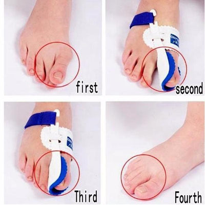 Bunion Corrector